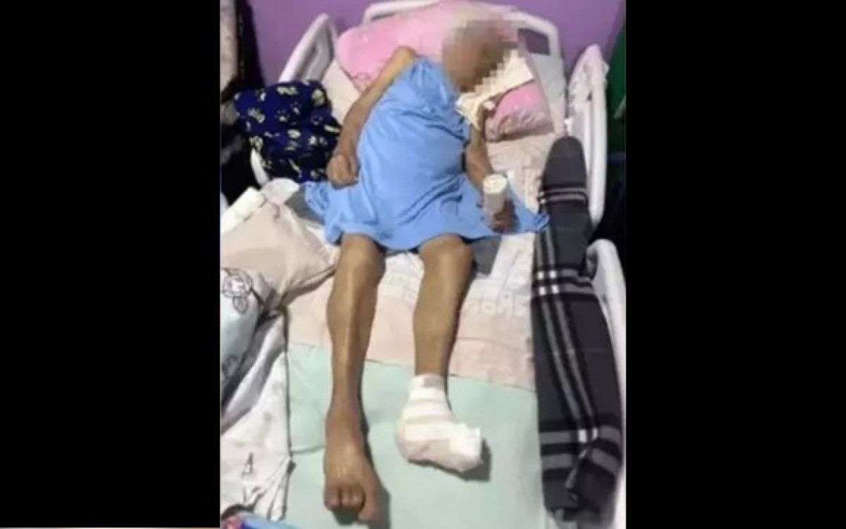 Idosa de 103 anos tem pé amputado em casa por enfermeira e sem anestesia